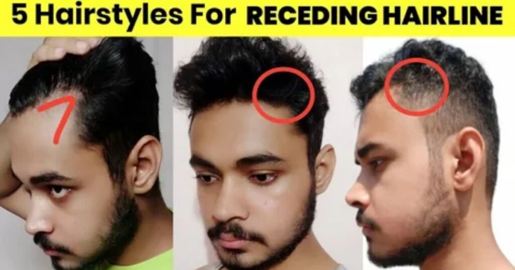 Caesar Cut For Receding Hairline