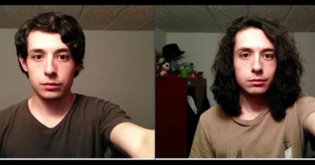 Perfectly Uniform Hair Growth From Day One