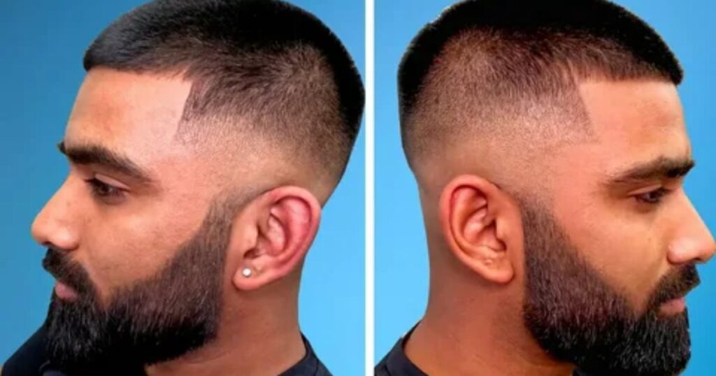 What Is A Number 2 Buzz Cut?